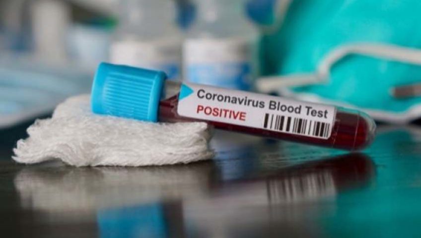 virus corona